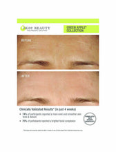 Load image into Gallery viewer, Green Apple Peel Sensitive Exfoliating Mask